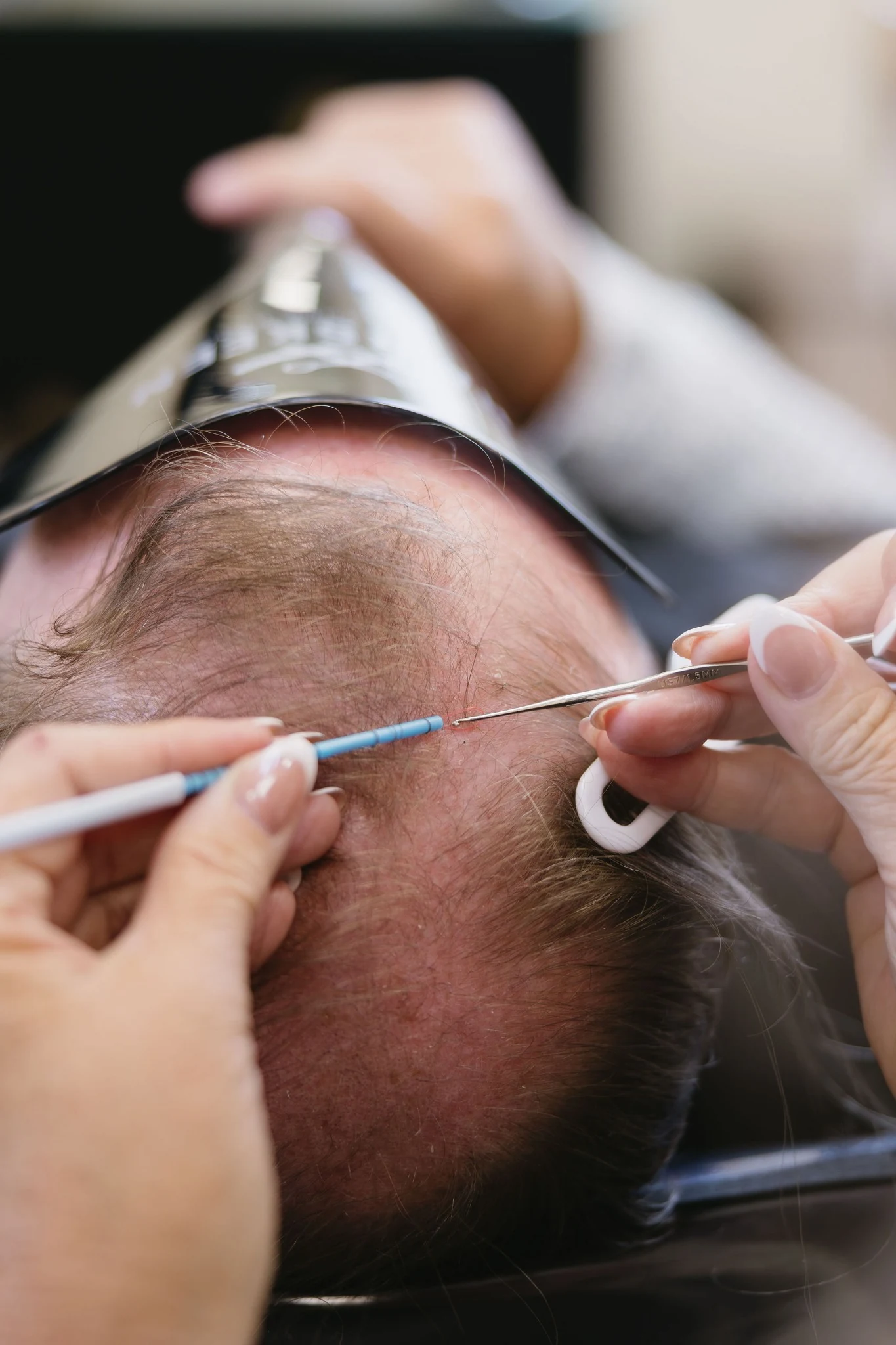 Close-up hair and scalp evaluation