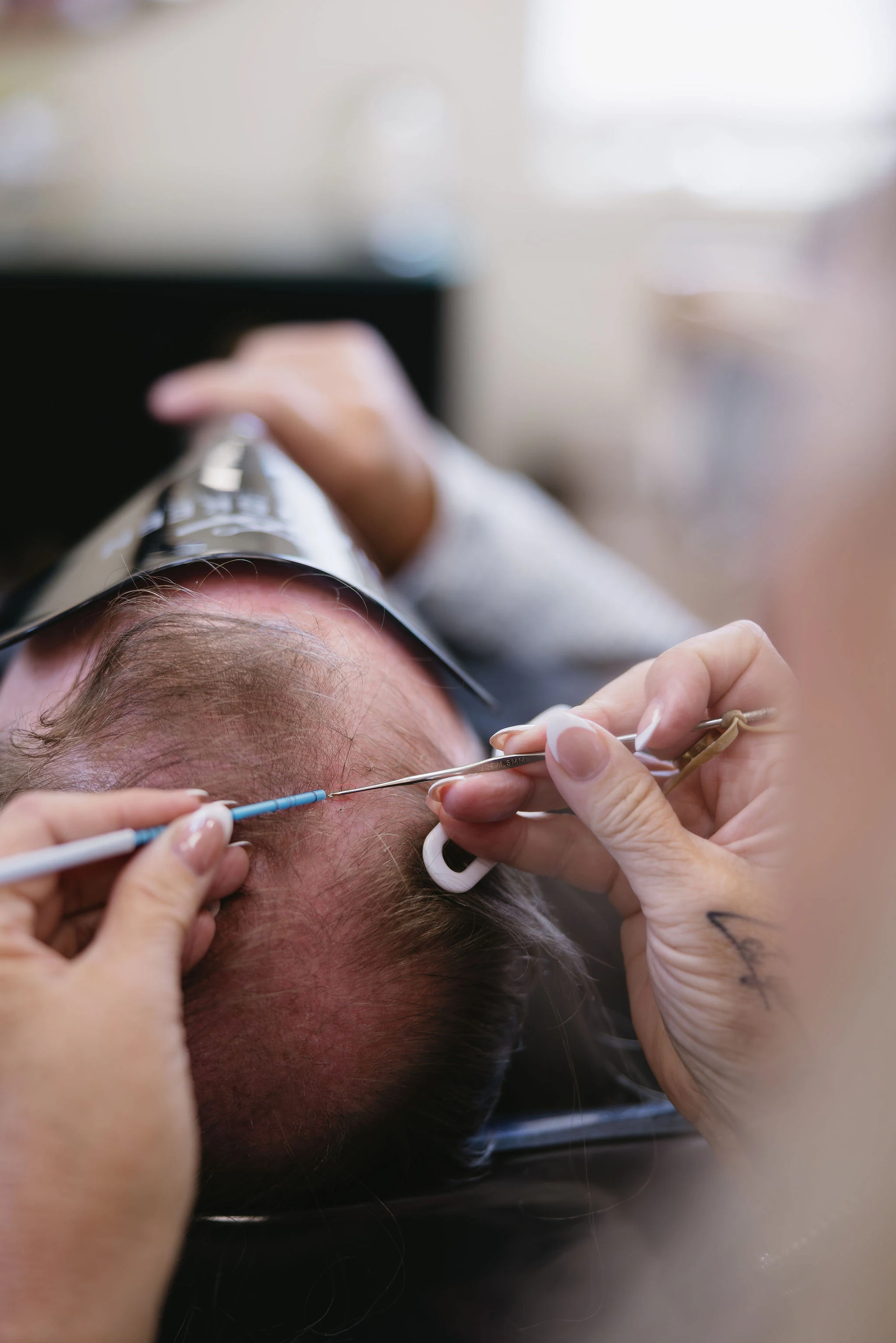 Close-up hair and scalp treatment at Another Look Hair Institute