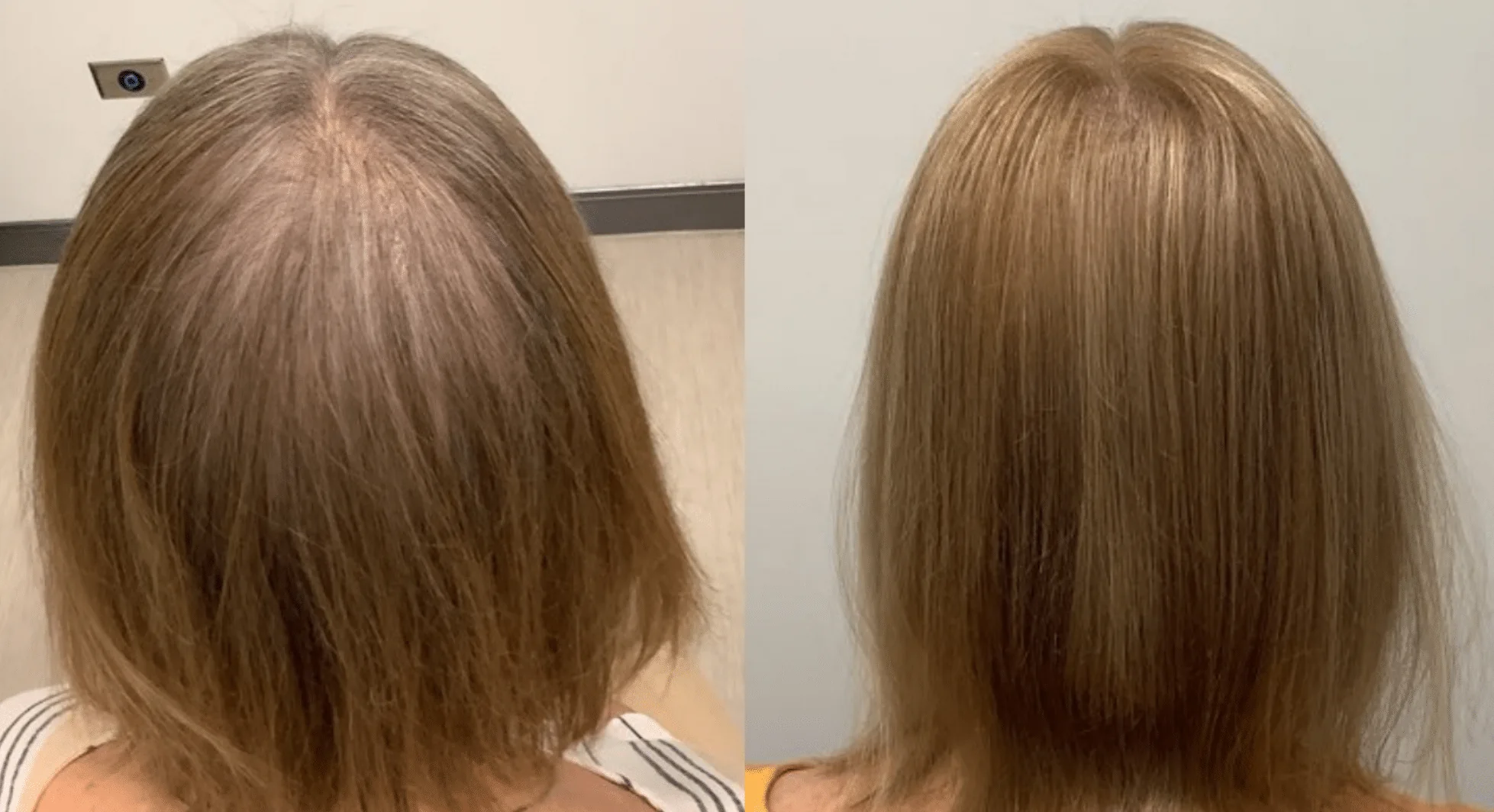 Before and after hair fullness example
